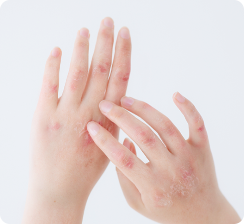 女性医師が丁寧に対応月曜午前に皮膚科外来スタート！