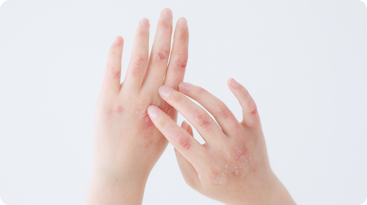 女性医師が丁寧に対応月曜午前に皮膚科外来スタート！